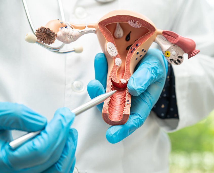 Saturn Pelvic Health - Flexsupp